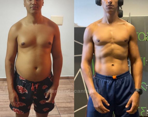 Antes X Depois