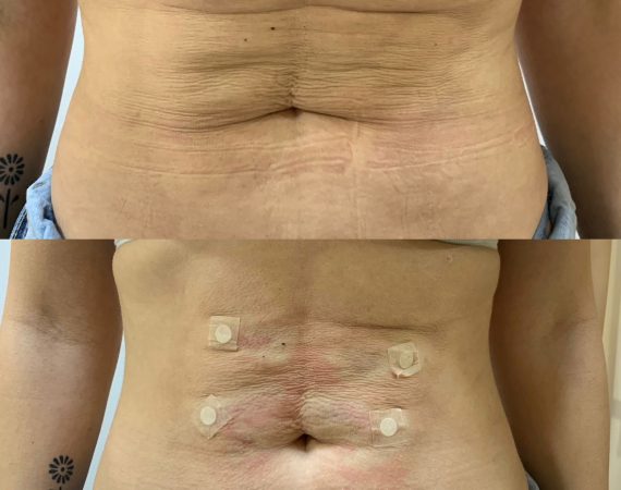 Procedimento estético