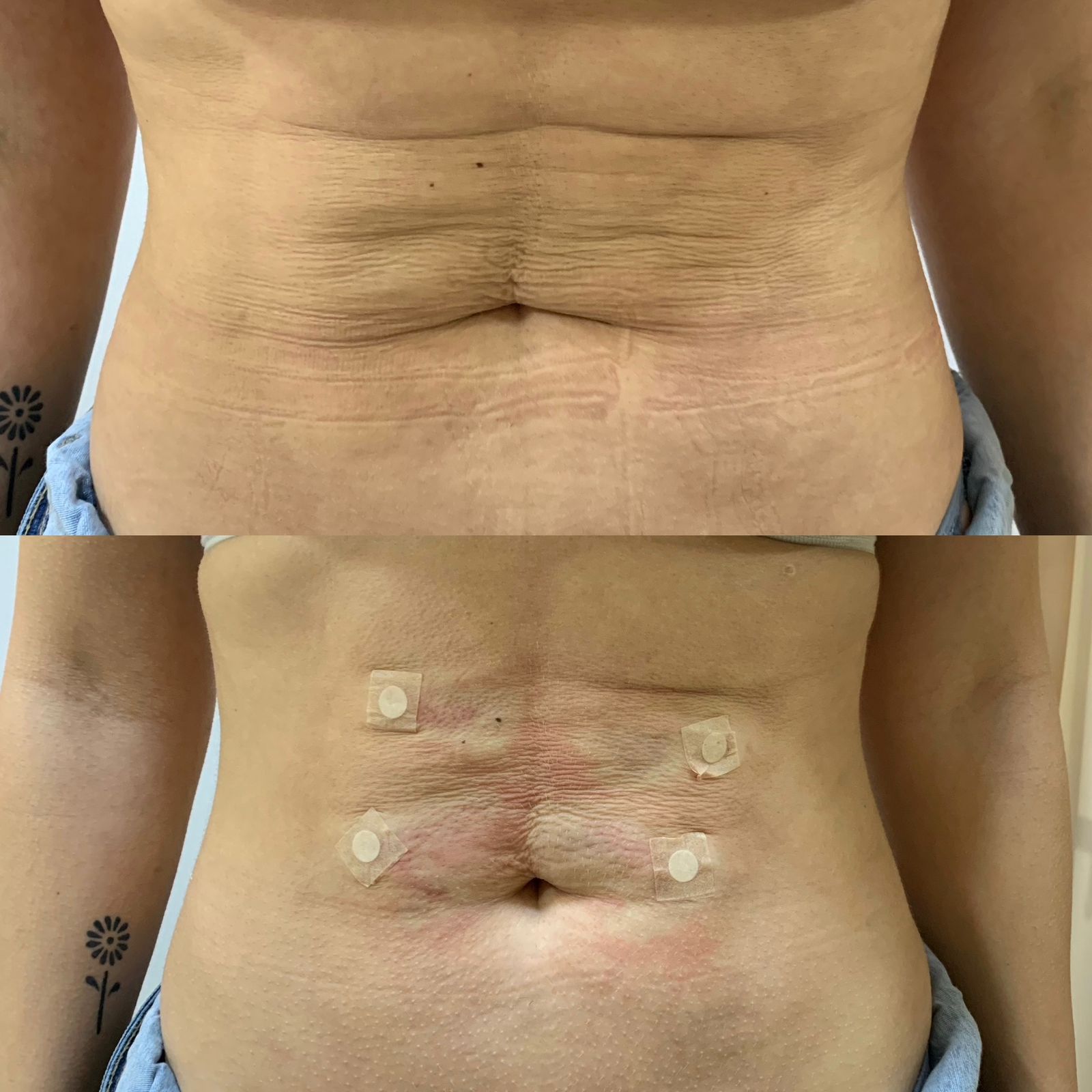 Procedimento estético