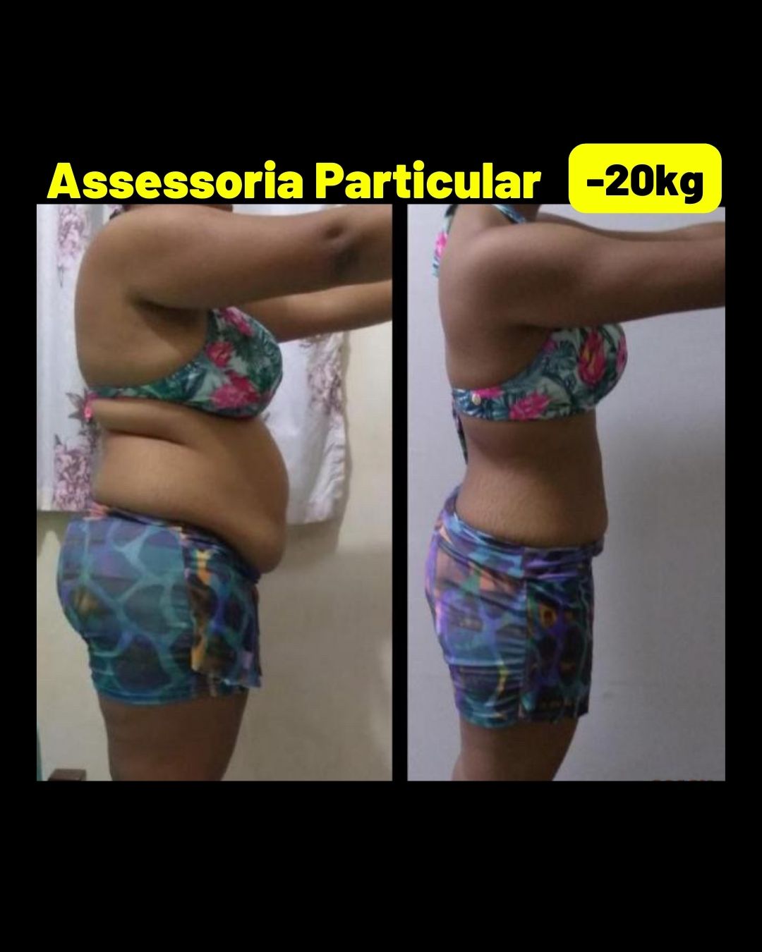 Antes X depois